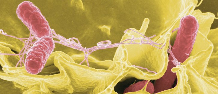 Antimicrobial resistance in food-borne pathogens, such as salmonella, shown here, is a growing worldwide problem.  |  File photo