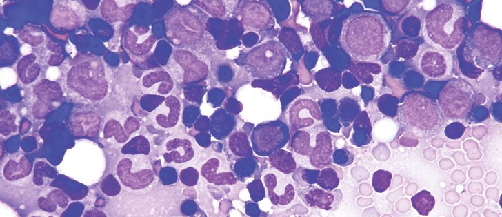 Cells like these use “self-eating” to conserve energy.
|  Jamie Rothenburger photo