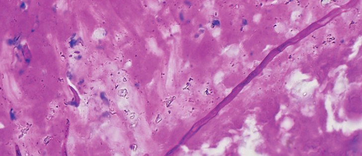 Fungal infections, like the one pictured here, are an important cause of emerging diseases in wild animals. |   Jamie Rothenburger photo