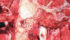 Microscopic lungworms are coiled in the lungs