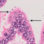 The microscopic parasite Cryptosporidium attaches to the intestinal lining, causing damage and diarrhea. | University of Calgary Veterinary Medicine photo