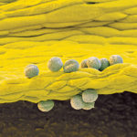 Researchers have succeeded in genetically optimizing canola plants to make them capable of producing unsaturated omega-3 fatty acids. These fatty acids can lower the risk of stroke and cardiovascular disease. | File photo