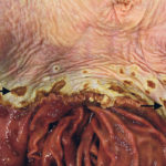 Ulcers develop when the thin stomach lining is lost, leaving the underlying stomach wall exposed. | University of Calgary Veterinary Medicine photo