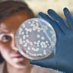 Kylee Drever examines Mycobacterium smegmatis in the tuberculosis lab at the Vaccine and Infectious Disease Organization-International Vaccine Centre in Saskatoon. Officials at the centre are excited about the potential of reverse vaccinology. | William DeKay photo