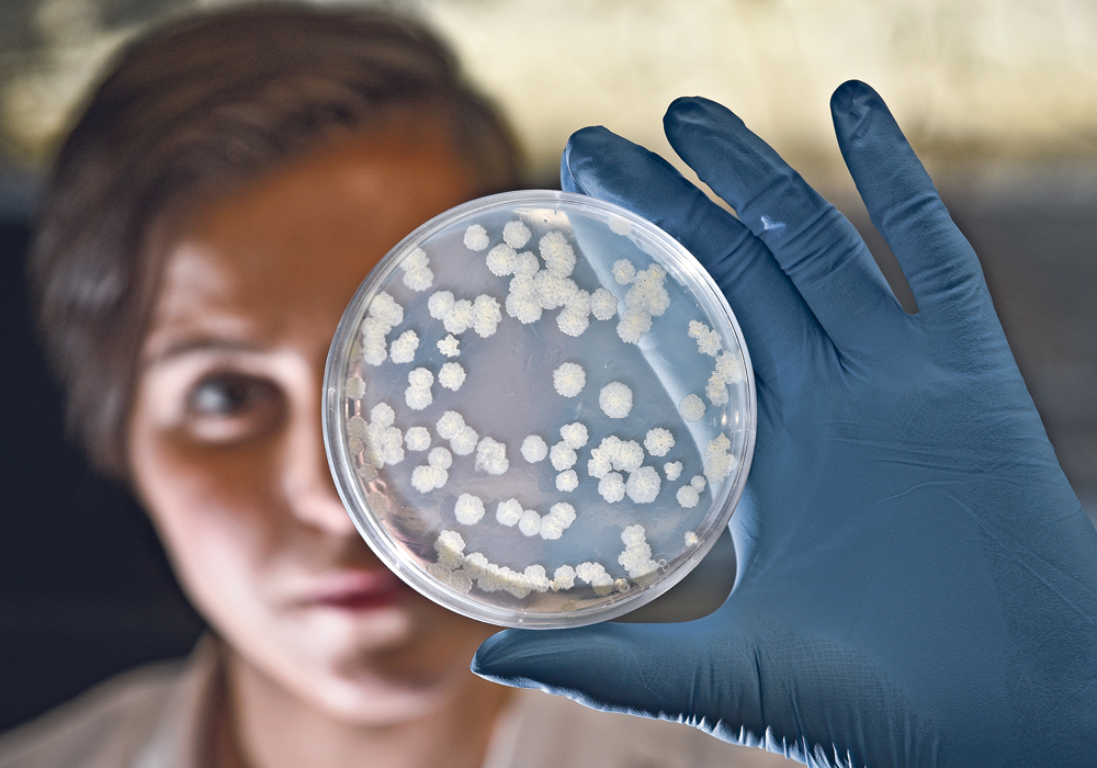 Kylee Drever examines Mycobacterium smegmatis in the tuberculosis lab at the Vaccine and Infectious Disease Organization-International Vaccine Centre in Saskatoon. Officials at the centre are excited about the potential of reverse vaccinology.   |  William DeKay photo