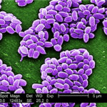 Anthrax spores live in the soil and are buoyant in water. When sloughs and potholes dry up, the spores remain and concentrate. Disease surveillance veterinarian Dr. Wendy Wilkins said as the grazing season winds down and animals get into less desirable forage the chances of getting to those spores increase. | National Institute of Standards and Technology [Public domain], via Wikimedia Commons photo