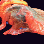 The lungs of this horse are collapsed and red, indicating severe pneumonia (arrows) and a failure of the respiratory defenses. | Jamie Rothenburger photo