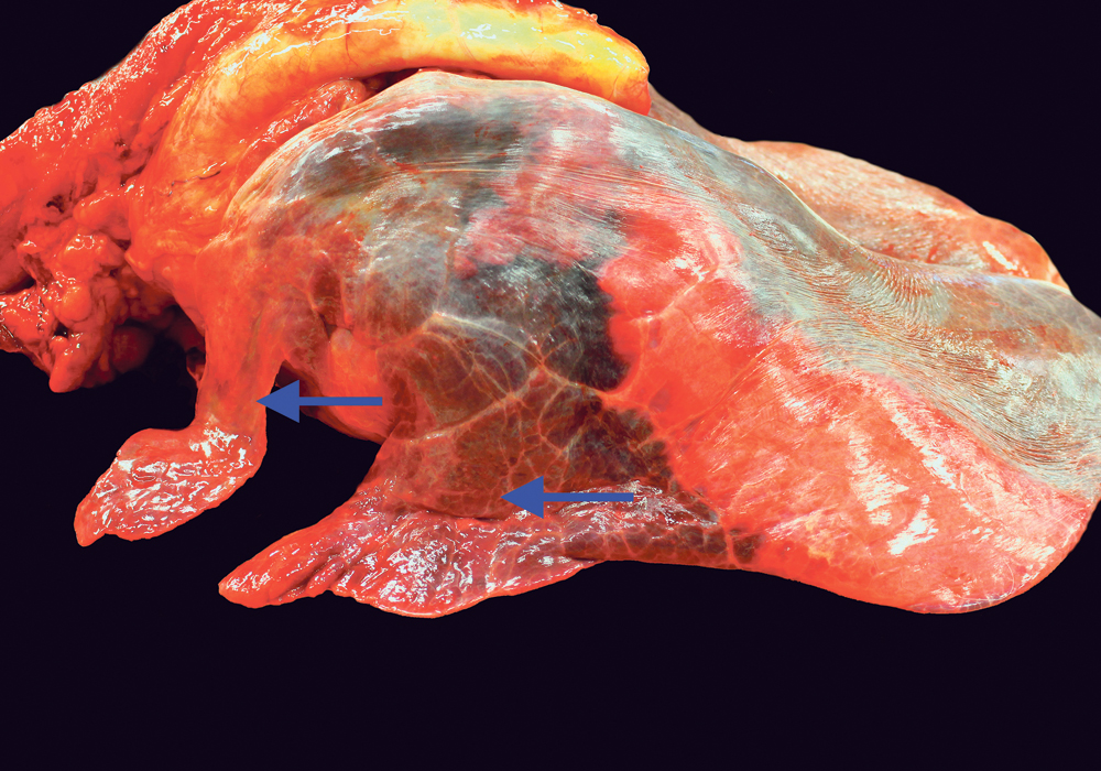 The lungs of this horse are collapsed and red, indicating severe pneumonia (arrows) and a failure of the respiratory defenses.  |  Jamie Rothenburger photo