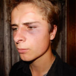 Jeremia Leussink was pulled from his tractor and injured by police while working last month. Sheriffs thought the young farmer was evading a check stop on the highway. | Maria Leussink photo