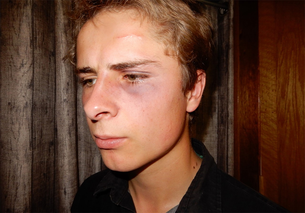 Jeremia Leussink was pulled from his tractor and injured by police while working last month. Sheriffs thought the young farmer was evading a check stop on the highway.  |  Maria Leussink photo