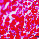 Globules of fat, shown in red, accumulate in the liver of a sick cow. | Jamie Rothenburger photo