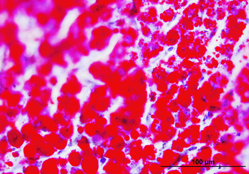 Globules of fat, shown in red, accumulate in the liver of a sick cow.  | Jamie Rothenburger photo