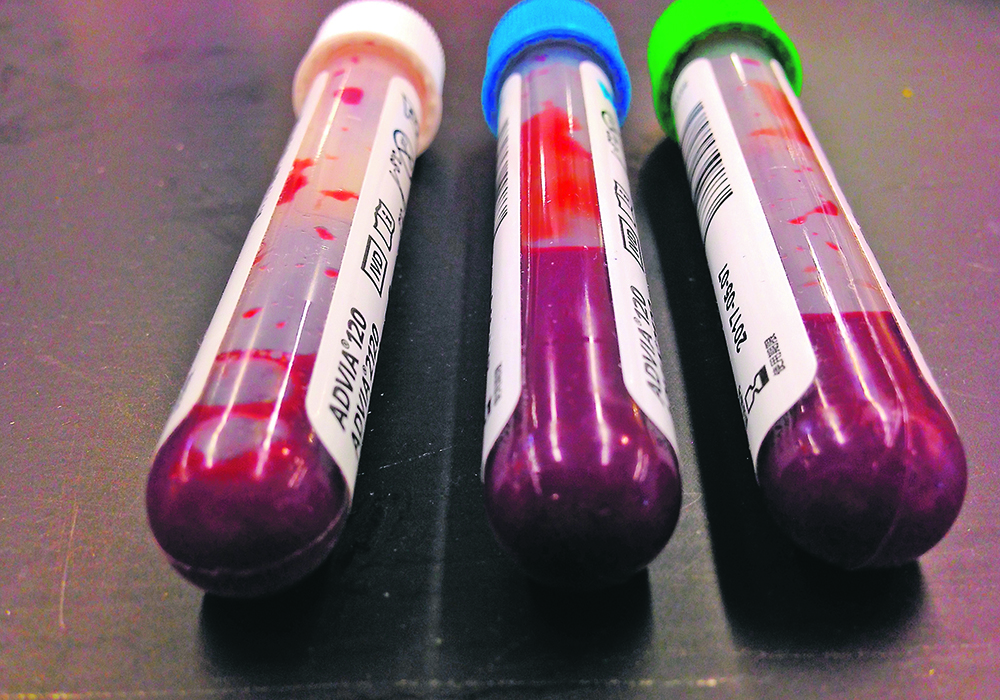 blood tubes