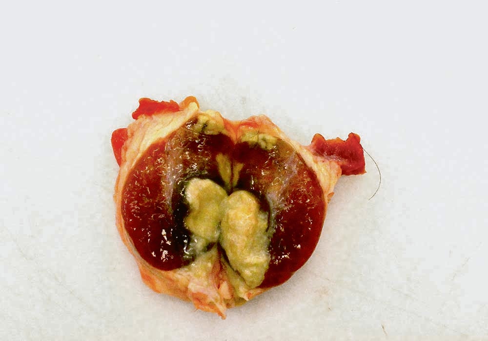 pus oozes from a amputated hoof on a white background