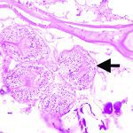 This microscopic image of liver cysts in muskrats from Calgary show protoscoleces (arrow), which will develop into the adult tapeworm if a dog or coyote eats them. | Jamie Rothenburger photo