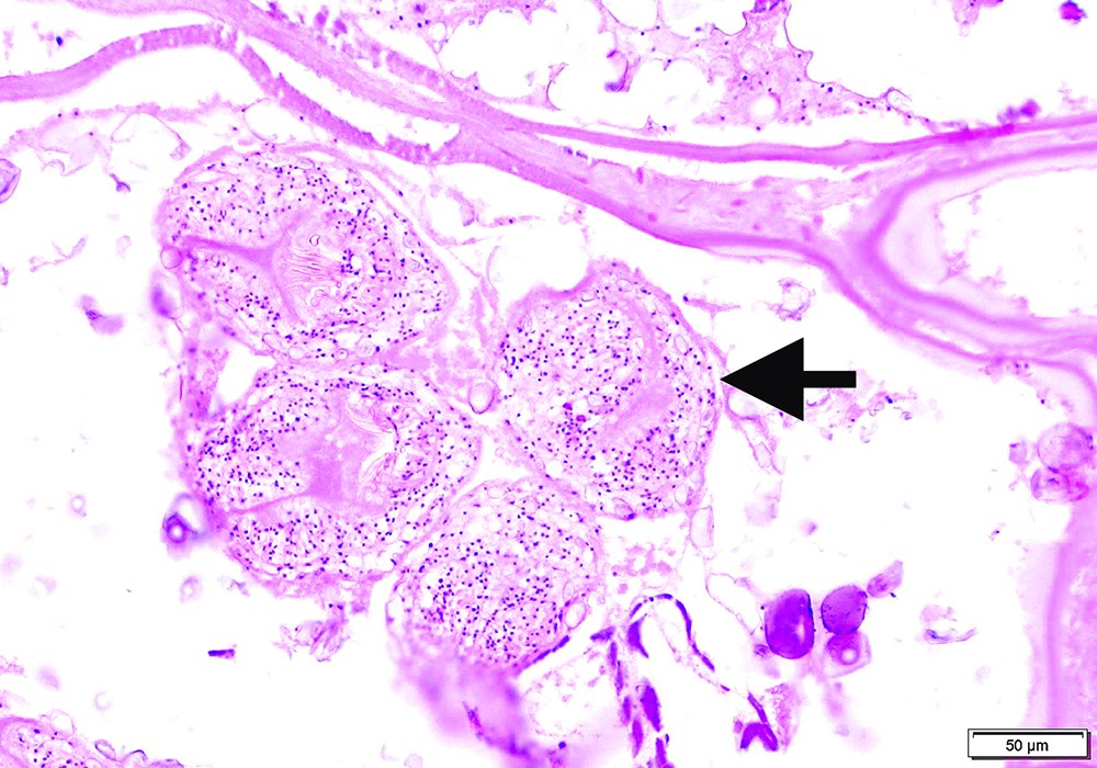 a microscopic image of liver cysts in muskrats