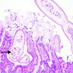 This microscopic image shows tiny tapeworms in the intestine of a coyote. | Jamie Rothenburger photo