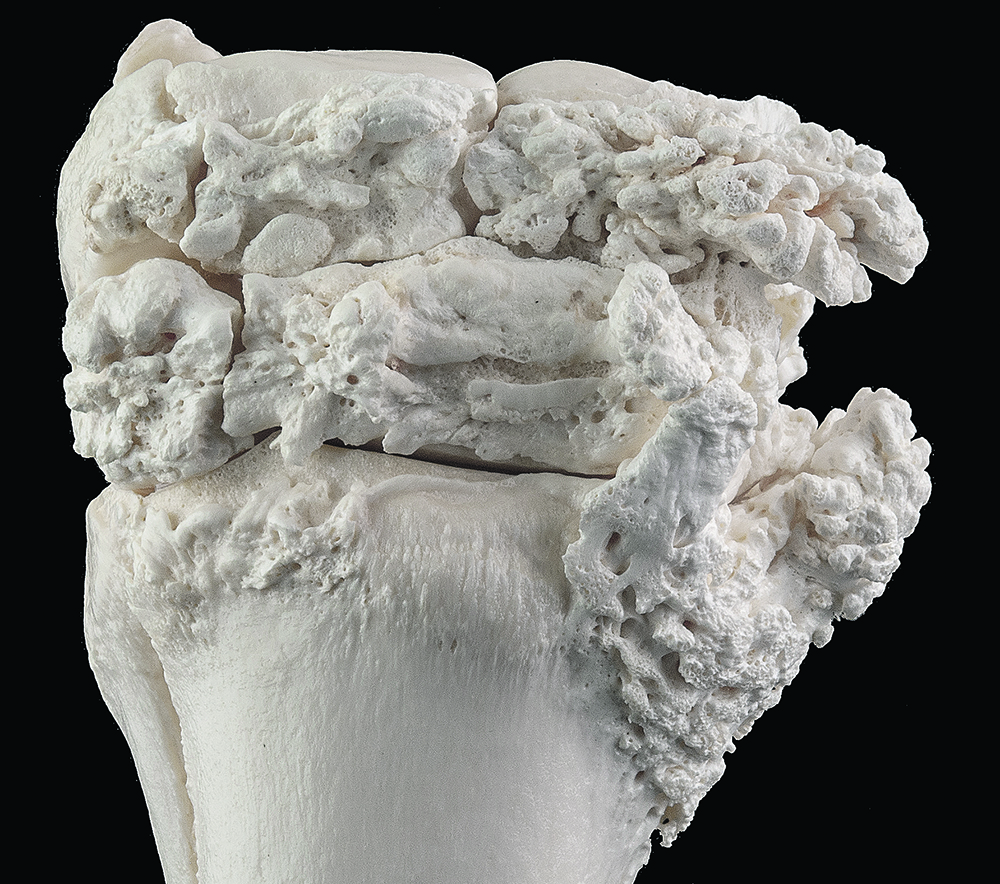 In this severely arthritic knee joint from a horse, the rough bone is a response to cartilage damage.  |  Jamie Rothenburger photo