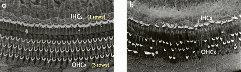 Three rows of outer hair cells and one row of inner hair cells line the cochlea of the human ear. The outer hair cells amplify our hearing, while the inner hair cells provide clarity of sound. When they’re damaged, there’s no medical treatment to restore them.  |  Photo supplied by Jason Schmiedge Photo