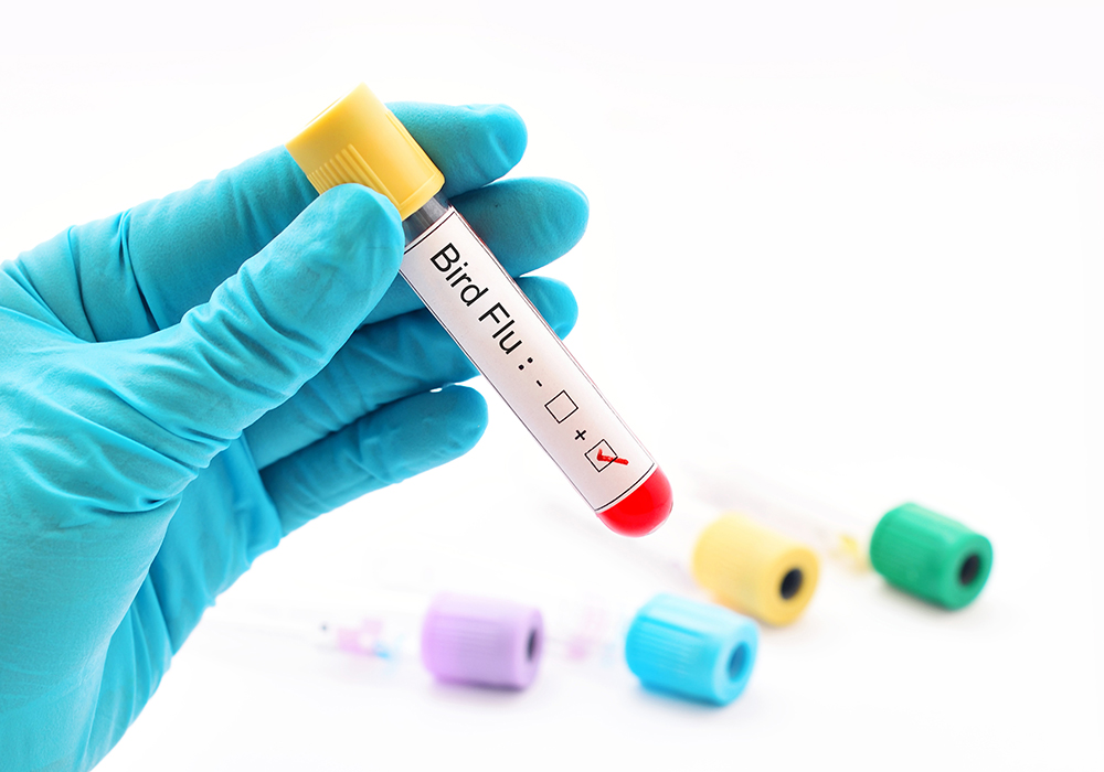 The number of people who were in contact with the hospitalized bird flu patient in Missouri and developed symptoms is now up to three, officials said. All three have recovered. | Getty Images