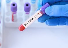 The CDC said partial viral genome data from the patient discovered the virus was part of the D1.1 genotype, the same one detected in infected wild birds and poultry in the United States, including human cases in Washington state. | Getty Images