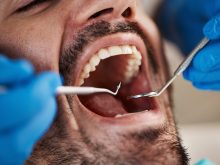 A close-up of a man's wide-open mouth with the blue, latex-gloved hands of a dentist holding two dental tools, about to work on his teeth.