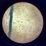 It takes practice to differentiate a parasite from detritus in a sample while under the microscope, which producers received during the Ontario Sheep Farmer Fecal Egg Count workshop in Lindsay on June 18, 2025. Photo by Diana Martin