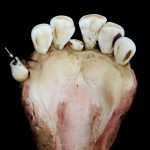 cavities in muskox teeth