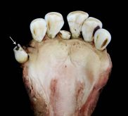 cavities in muskox teeth