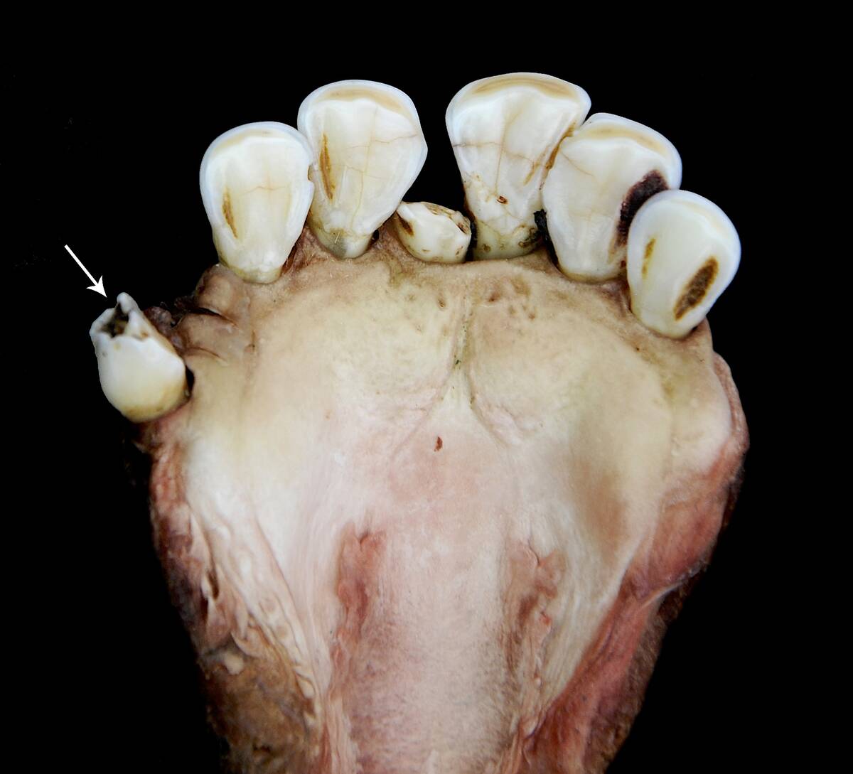 cavities in muskox teeth