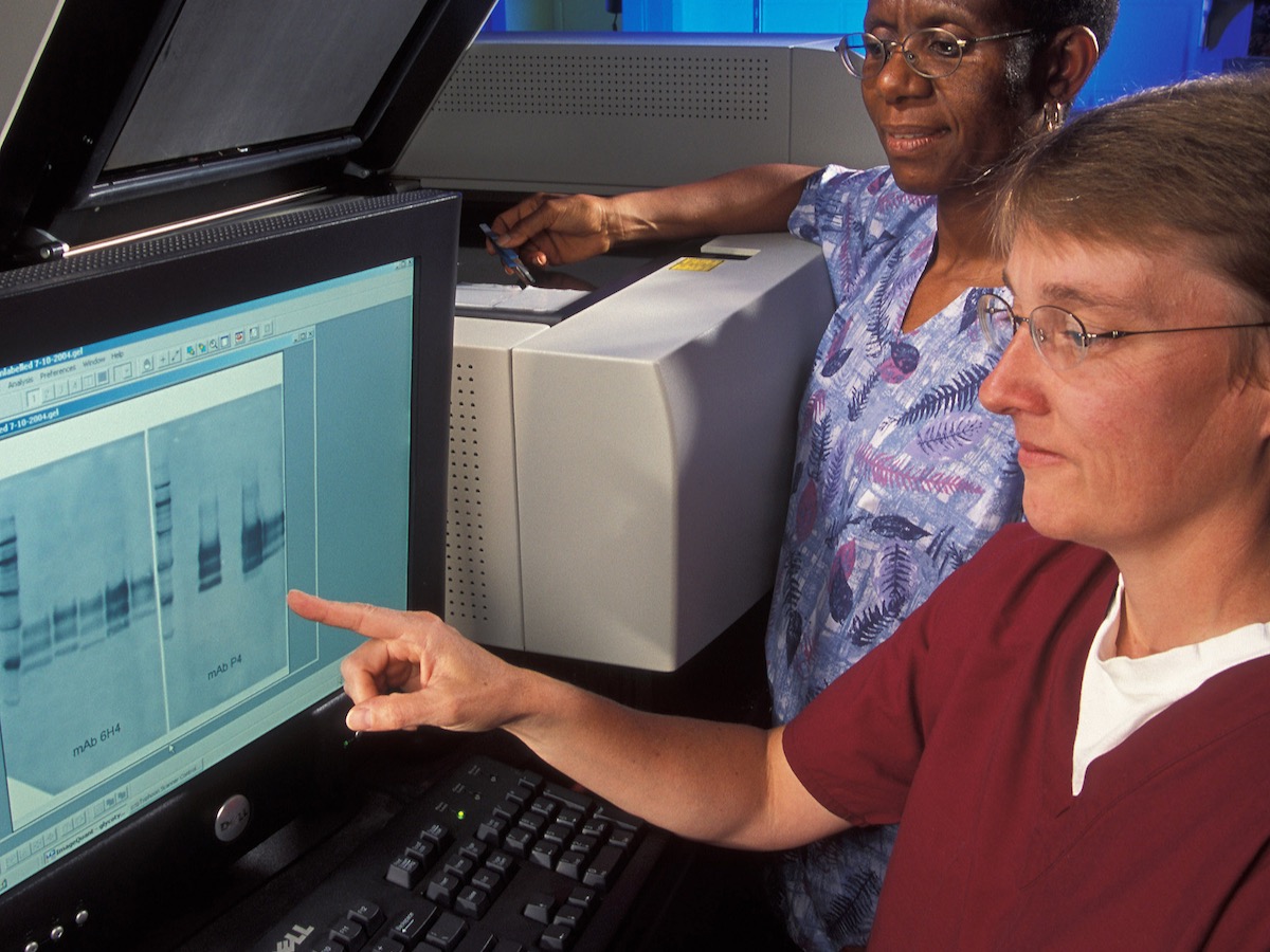 western blot analysis for BSE