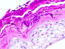 Arrows indicate the bright purple fungi within the pink outer skin layer in this microscopic image. Photo: Dr. Jamie Rothenburger
